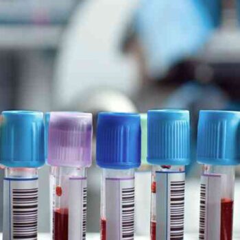 Paquetes en promoción